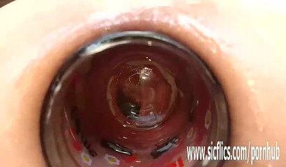 Anal fisting and extreme insertions amateur